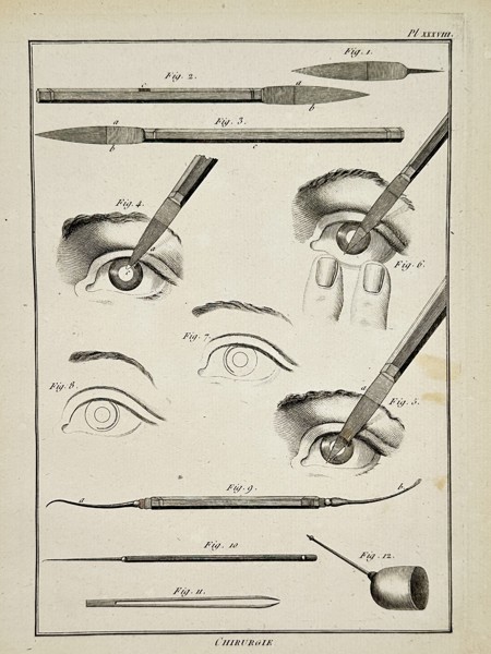 Robert Bénard (1734–1777) – Technical Study of Ophthalmic Surgical Instruments and Procedures – Engraving (18th Century)