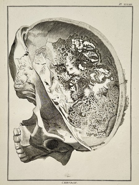 Robert Bénard (1734–1777) – Anatomical Study of a Human Skull – Engraving (18th Century)