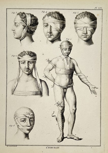 Robert Bénard (1734–1777) – Technical Study of Medical Bandages – Engraving (18th Century)