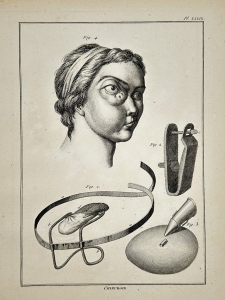 Robert Bénard (1734–1777) – Technical Study of Ophthalmic Pathology and Surgical Support – Engraving (18th Century)