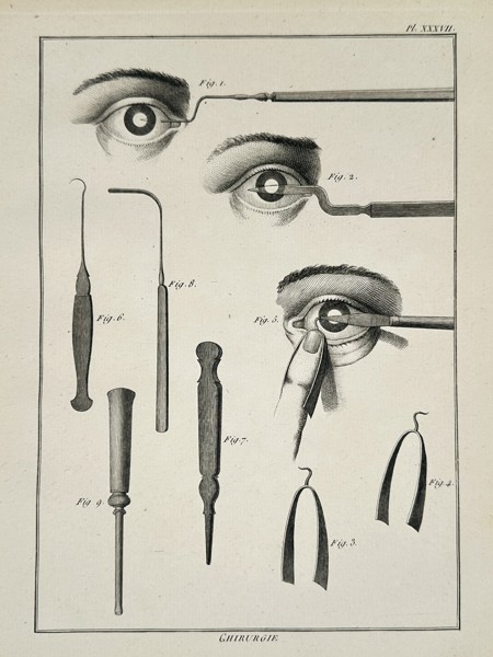 Robert Benard (1734-1785) – Ophthalmic Surgical Instruments and Procedures – Engraving (1771)