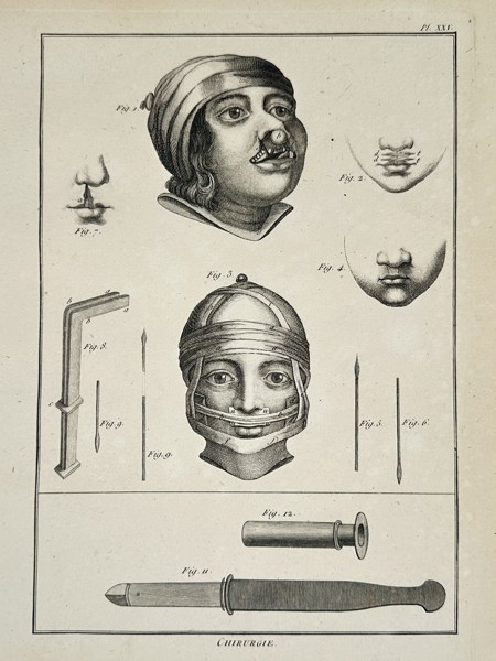Robert Benard (1734-1785) – Maxillofacial Surgery and Bandaging – Engraving (1771)