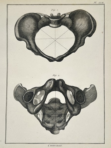 Robert Benard (1734-1785) – Anatomical Study of the Pelvis – Engraving (1771)