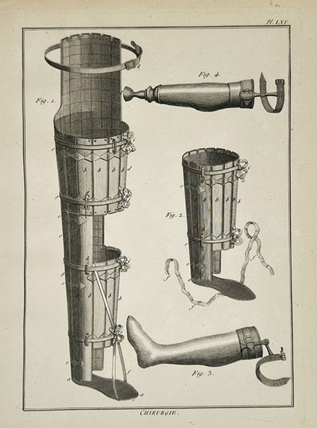 Robert Benard (1734-1785) – Orthopedic Leg Splints and Prosthetics – Engraving (1771)