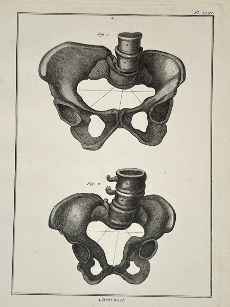 Denis Diderot (1713–1784) – Anatomical Study of the Pelvis and Vertebrae – Engraving (1762–1772)
