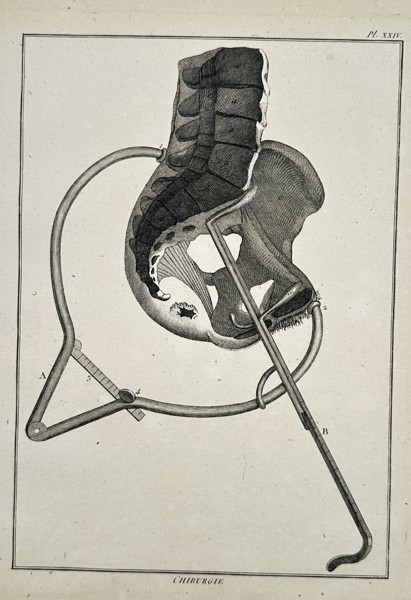 Robert Benard (1734–1777) – Anatomical Study of the Pelvis and Surgical Pelvimeter – Engraving (1762)