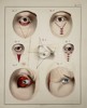 Paul Steglich (Active 19th Century) – Surgical Diagrams of Ophthalmic Procedures – Hand-coloured engraving (1840)