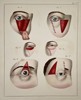 Paul Steglich (Active 19th Century) – Surgical Diagrams of Periorbital Tissue Flap Procedures – Hand-coloured engraving (1840)