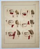 Paul Steglich (Active 19th Century) – Surgical Diagrams of Malar and Periorbital Flap Procedures – Hand-coloured engraving (1840)
