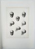 Friedrich Eppinger (Active Mid-19th Century) – Comparative Anatomical Studies of the Human Skull – Lithograph (1854)