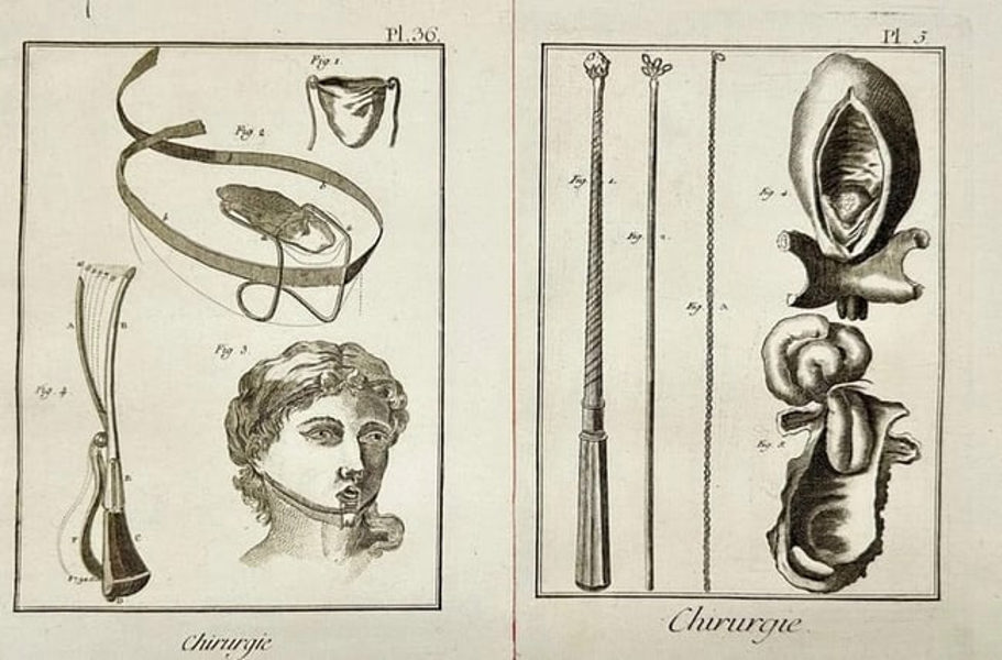 Denis Diderot (1713–1784) – Set of 2 Copperplate Engravings of Surgical Instruments & Anatomy