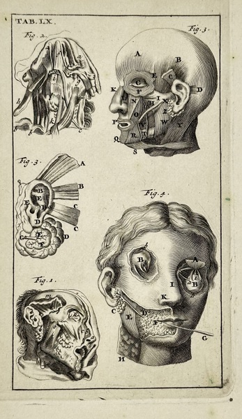 Stephanus Blankaart (1650–1704) – Tab. IX (Head and Facial Anatomy) – Copperplate Engraving – Late 17th Century