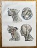 August Krausse (1803–1896) – Anatomy of the Human Head and Neck – Engraving (c. 1860)
