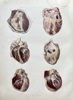 Julius von Henle (1809–1885), Krausse (active c. 1850s) and Eltzner (active c. 1850s) – Anatomy of the Human Heart – Hand-coloured engraving (c. 1860)