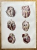 Julius von Henle (1809–1885), Krausse (active c. 1850s) and Eltzner (active c. 1850s) – Anatomy of the Human Heart – Hand-coloured engraving (c. 1860)