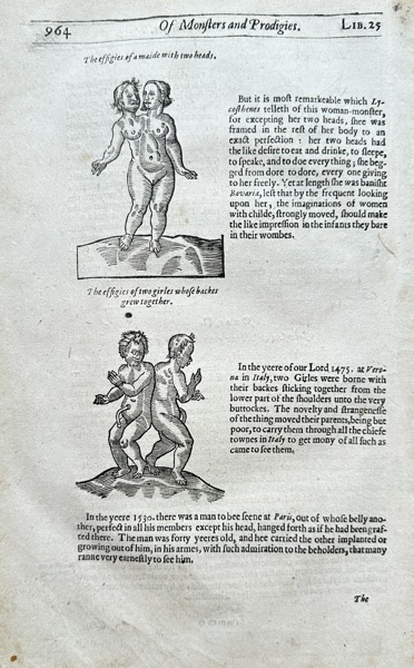 Ambroise Paré (1510–1590) – Of Monsters and Prodigies: Two-Headed Maid and Conjoined Twins (Liber 25) – Woodcut (1634)