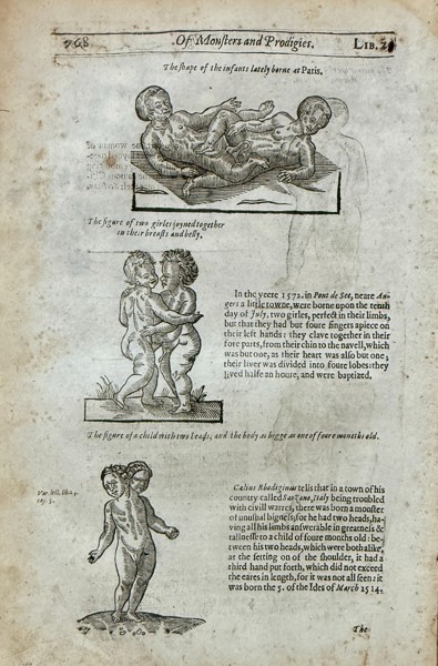 Ambroise Paré (c. 1510–1590) – Of Monsters and Prodigies (Human Anatomical) - Engraving