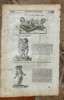 Ambroise Paré (c. 1510–1590) – Of Monsters and Prodigies (Human Anatomical) - Engraving