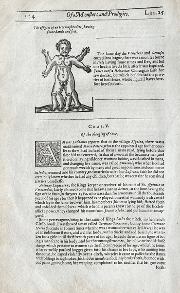 Ambroise Paré (c. 1510–1590) – Illustration of a Human Anomaly – Woodcut (1634)