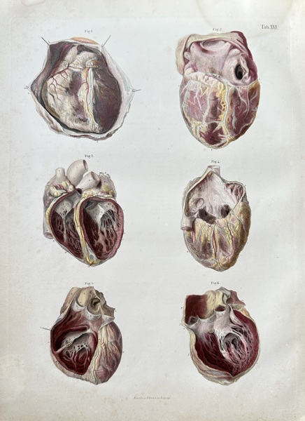 Julius von Henle (1809–1885), Krausse (active c. 1850s) and Eltzner (active c. 1850s) – Anatomy of the Human Heart – Hand-coloured engraving (c. 1860)