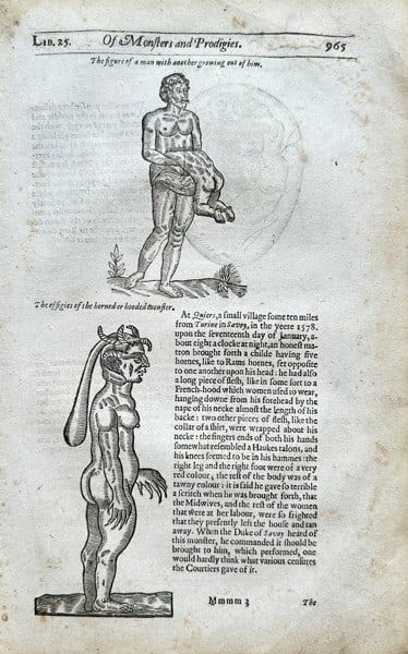 Ambroise Paré (1510–1590) – Of Monsters and Prodigies: Man with Master-Growth