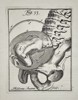 Hendrik van Deventer (1657–1724) - Fetus Presentation in the Pelvis - Copperplate Engraving (Early 18th Century)