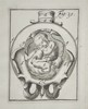 Hendrik van Deventer (1657–1724) - Twin Fetus Presentation in the Pelvis - Copperplate Engraving (Early 18th Century)